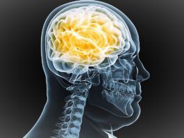 ¿La obesidad puede causar daños neuronales? Radiografía de la cabeza de una persona con sobrepeso
