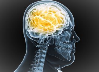 Radiografía de la cabeza de una persona con sobrepeso