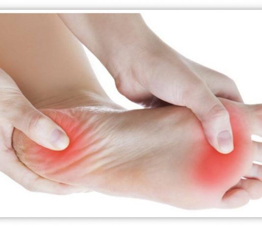Relación entre la fascitis plantar y la alimentación fascitis plantar